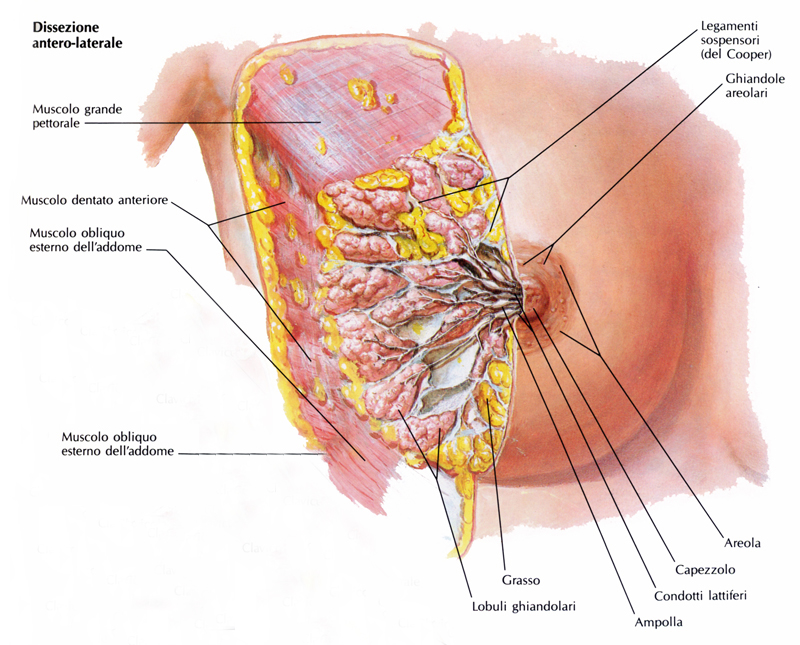 papilloma dei dotti del seno